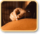 The Photo of Acupuncture